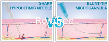 China Fabricantes fornecer alta quaily 25g 50mm micro ponta sem corte agulha cânula plain termina entalhado endo ponta de agul supplier