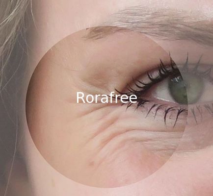 2018 Best Seller Toxin Botulax 100 Units Type a supplier