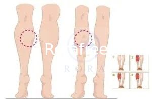 2019 Korea Type a Botulax 100units supplier