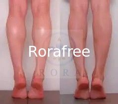 Absorbable Botulax 100 Unit Botulim Toxin a Brotox Price supplier