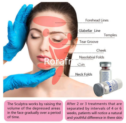 Facial Rejuvenation Plla  Dermal Filler for Smile Lines supplier