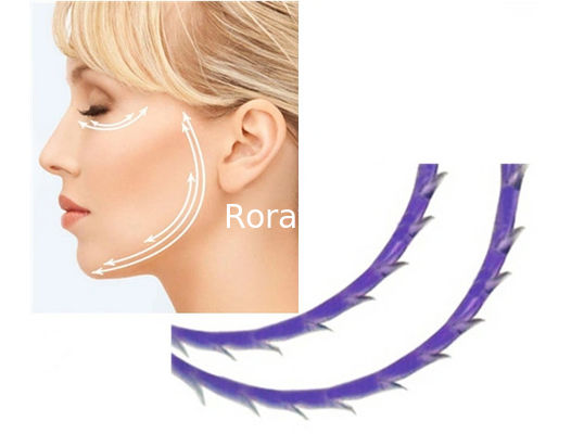 Beauty Pdo Mono Screw Thread for Face Lifting supplier