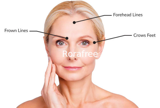 Anti Aging Botulium Toxin Botulax Meditoxin Nabota Powder Injection supplier