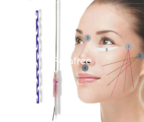 Korea Beauty Pdo Thread Nose Lift Eye Face Skin Lifting Multilayer Cog 3d 4d 6d Mono Tornado Screw Thread supplier